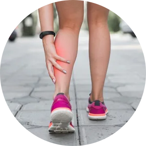 Shin Splints